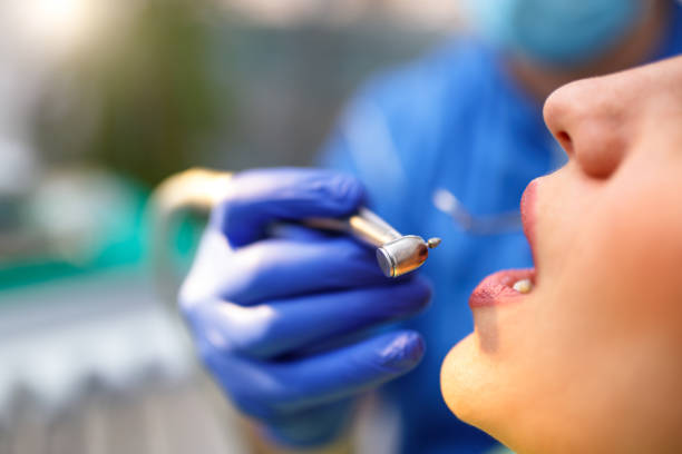 Why Choose Us for Your Dental Needs in Castro Valley, CA